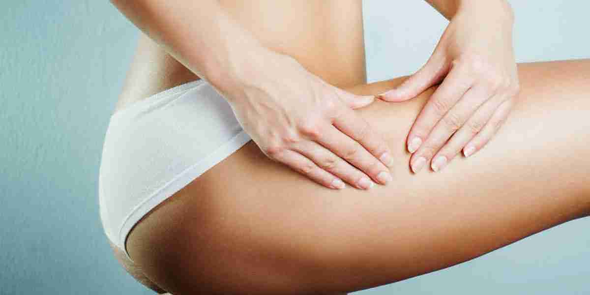 Top 7 Facts About Cellulite Reduction in Los Angeles